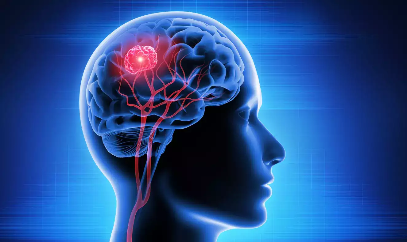New Hope for Brain Cancer Patients