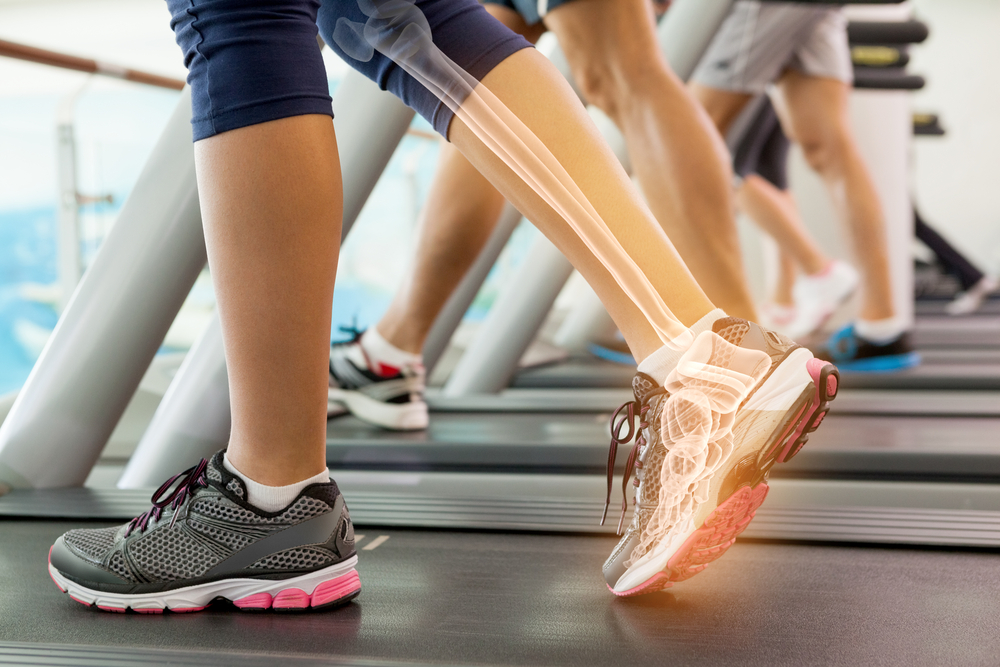 Custom Orthotics in Abbotsford